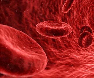 Blood cancer (stock photo)